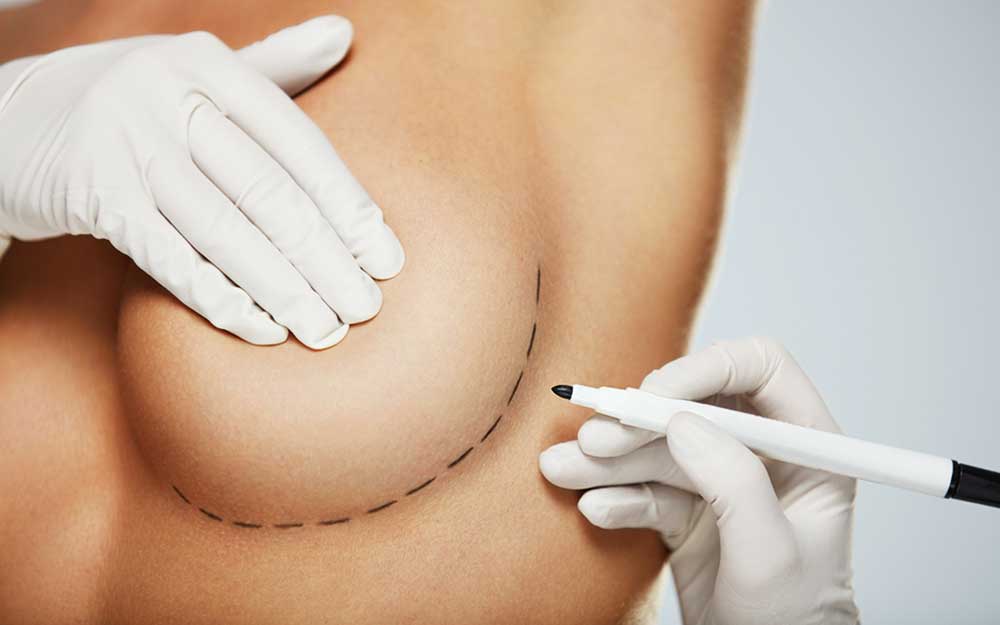 Lift and breast prosthesis.seo