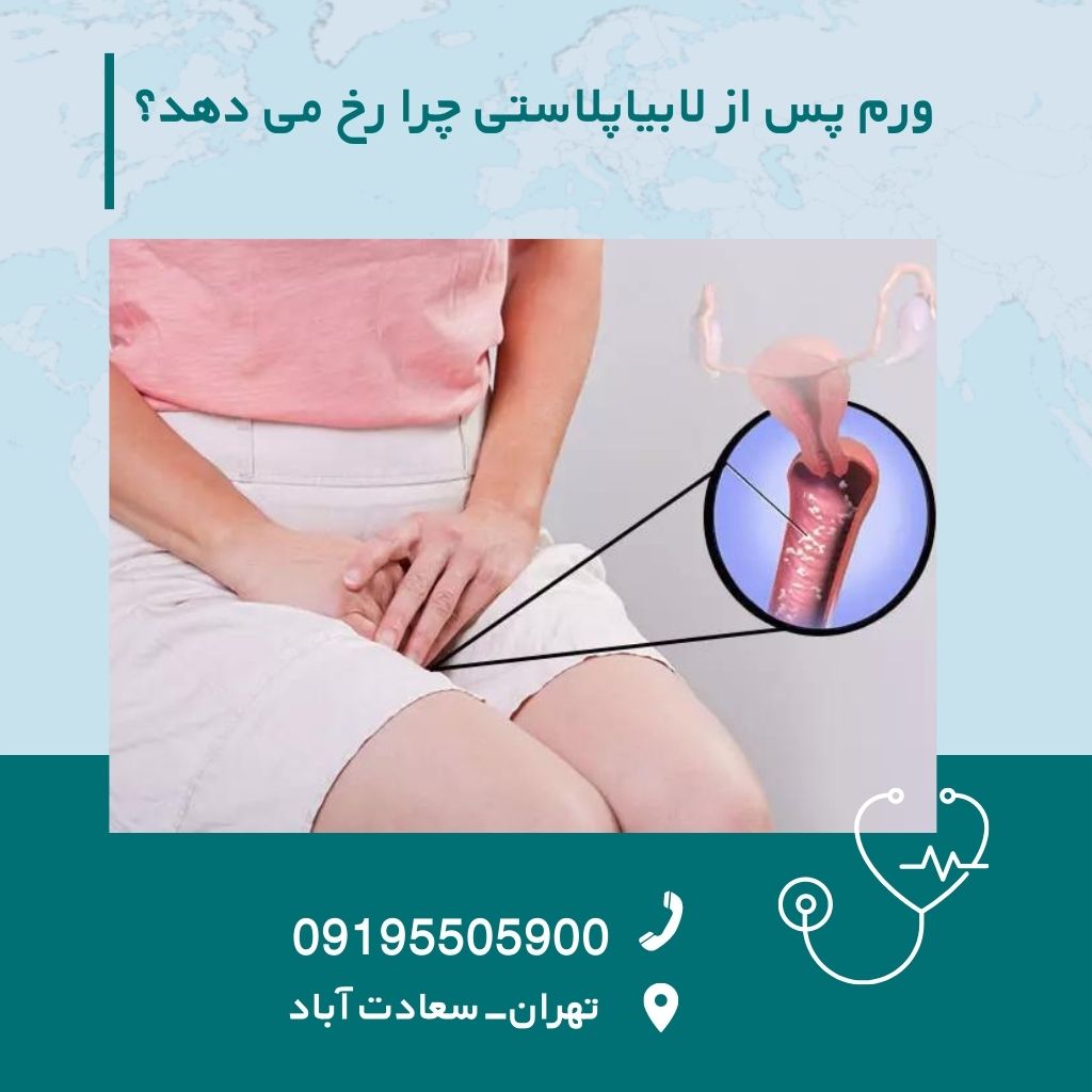 ورم پس از لابیاپلاستی چرا رخ می دهد؟ کلینیک بیتا