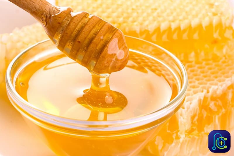درمان خانگی کیست مویی با عسل