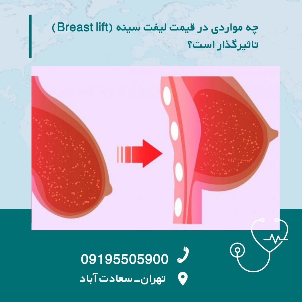 هزینه لیفت سینه هزينه جراحی ليفت سينه با ليزر Cost Breast Lift
