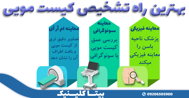 راه های تشخیص کیست مویی