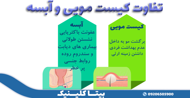 عکس و فیلم سرطان کیست مویی