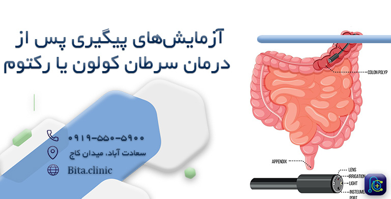 آزمایش های پیگیری پس از درمان سرطان کولون یا رکتوم