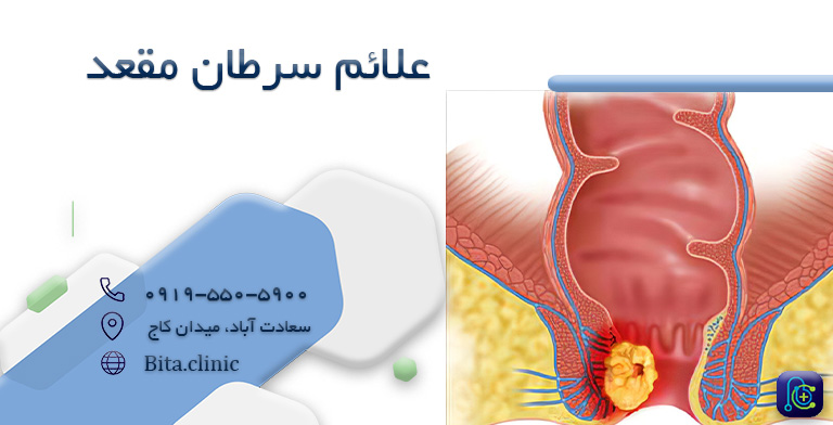 علائم سرطان مقعد