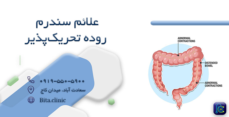 علائم سندرم روده تحریک پذیر