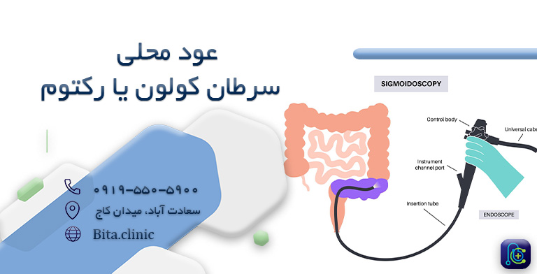 عود محلی سرطان کولون یا رکتوم